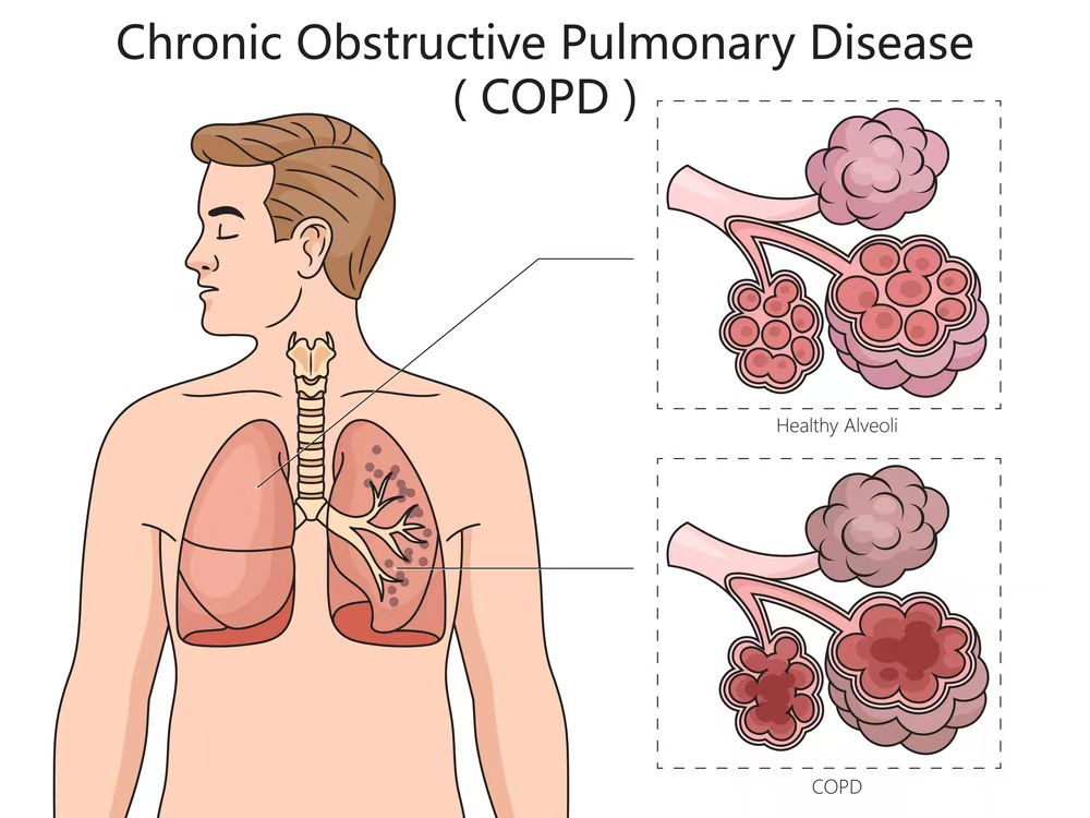 f2ff1bf3f6b9ed2512bb14b822a3a665